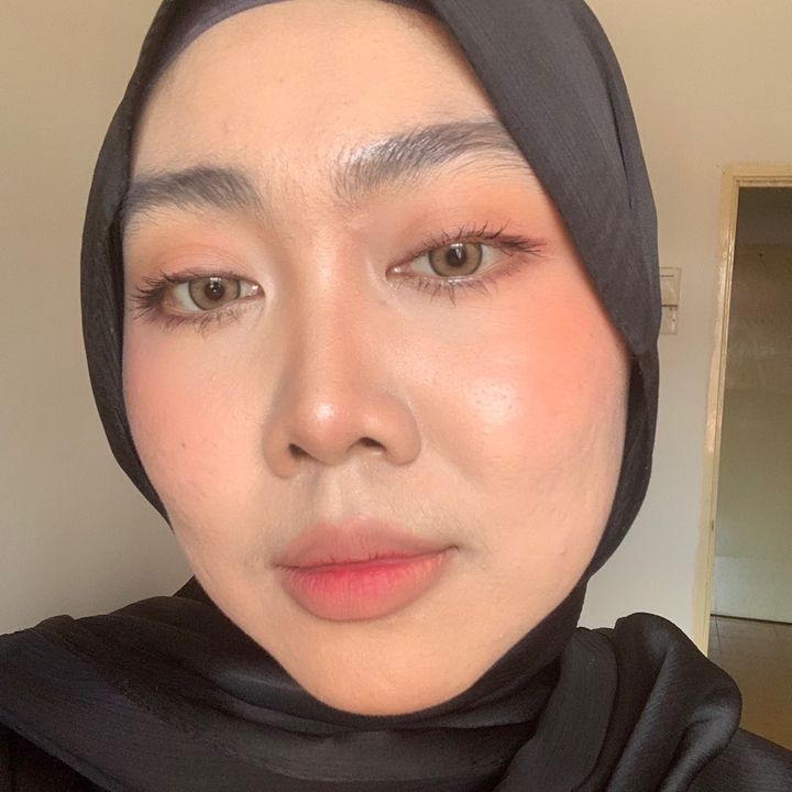 Kinnbeauty