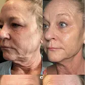 Beauty Results Queen