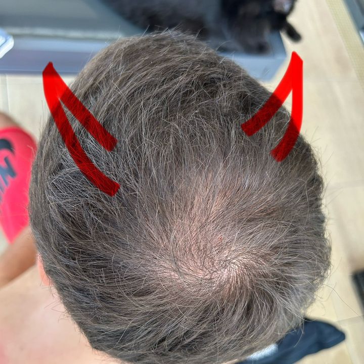 Calvasse la menace