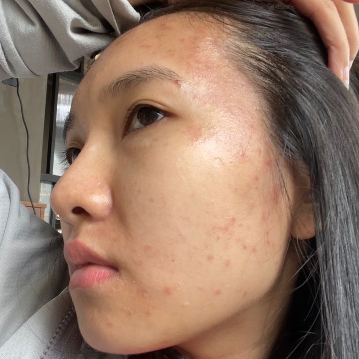 Lột xác cùng duyên