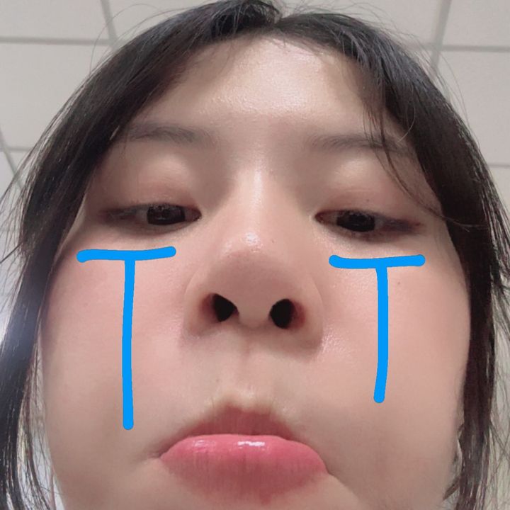 Ỏ
