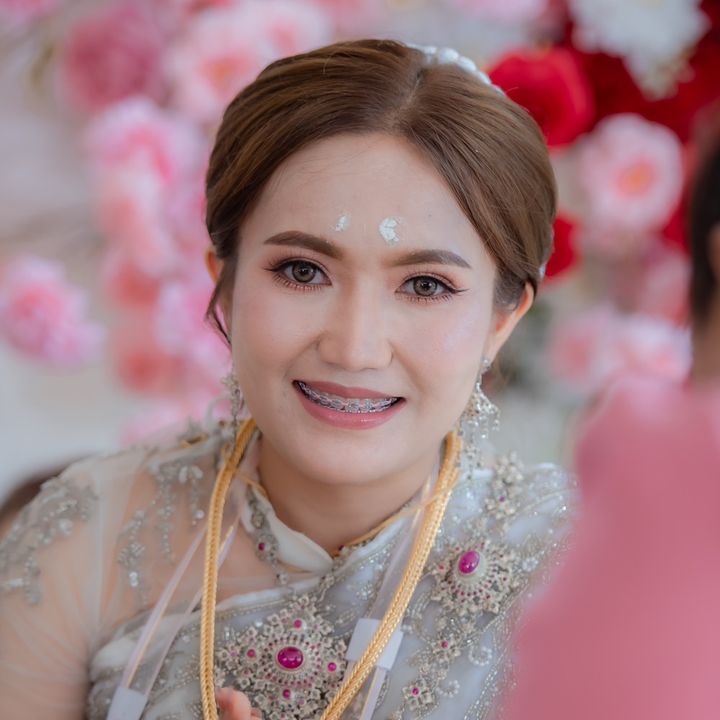 กล้วยหอม กระต่ายเถื่อน