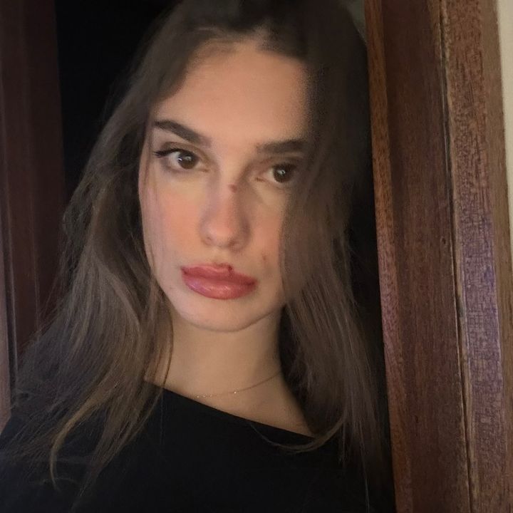 Becca