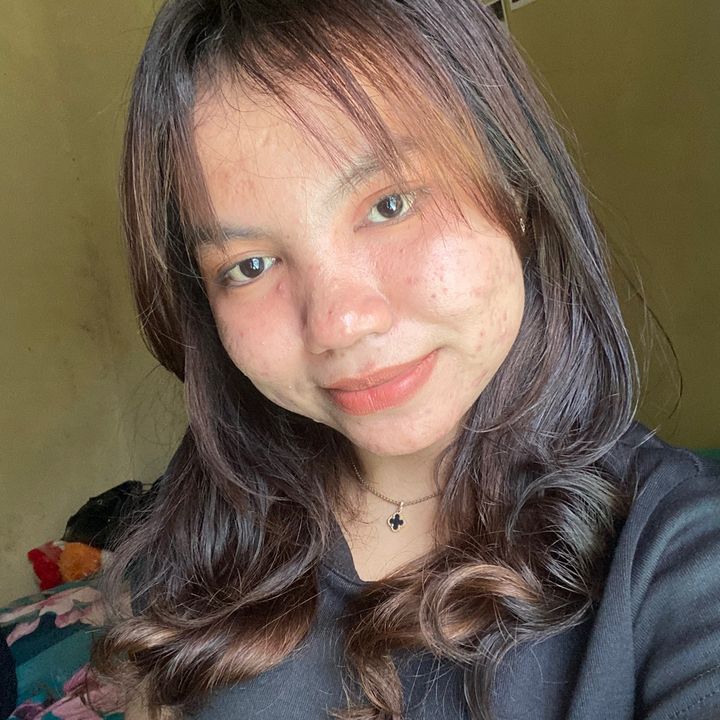 ais | acneproneskin