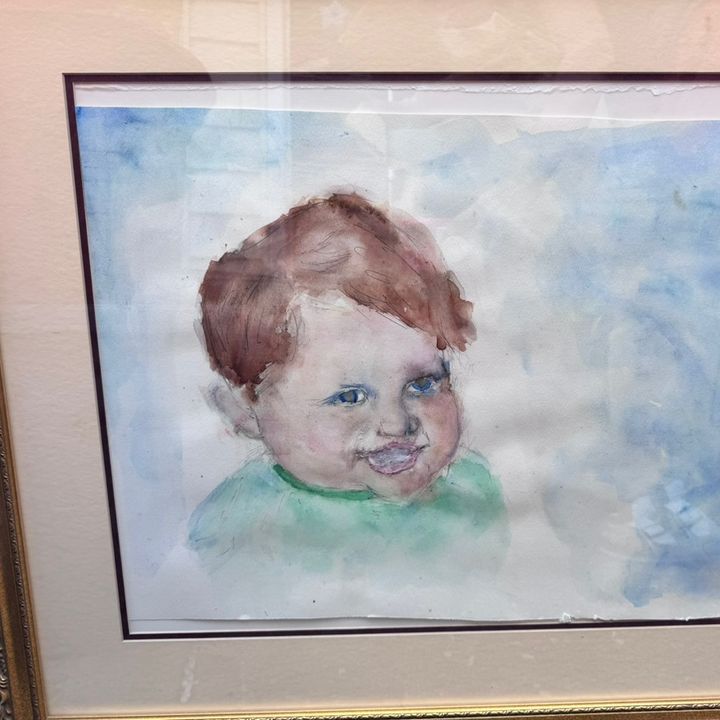 Cleft