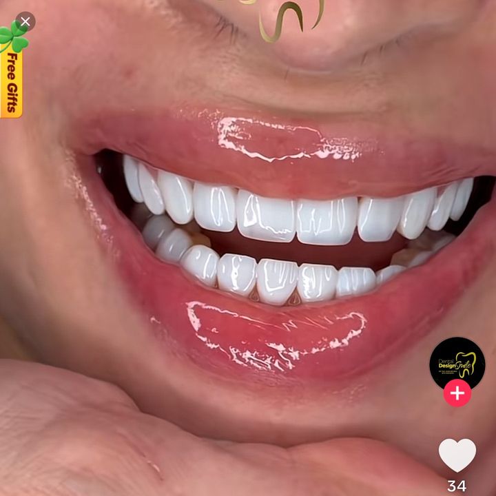 White teeth 2