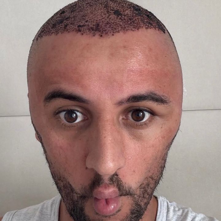 Alemãolider00