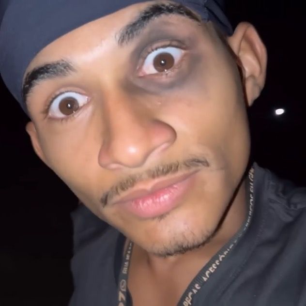CACHORRADA