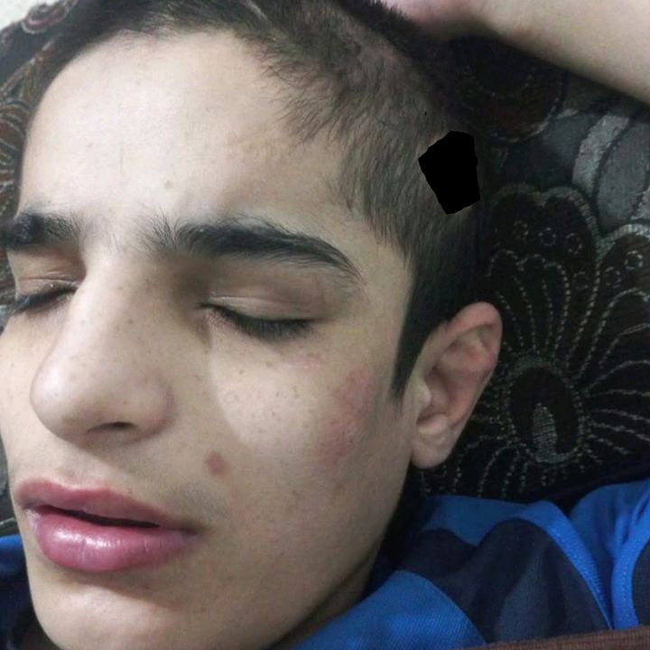 ♿حالة انسانية ايمن ♿