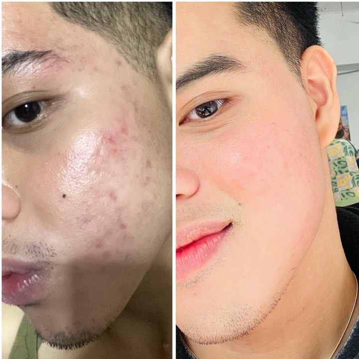 Renz | Medtek.3.0💉🍀🧿