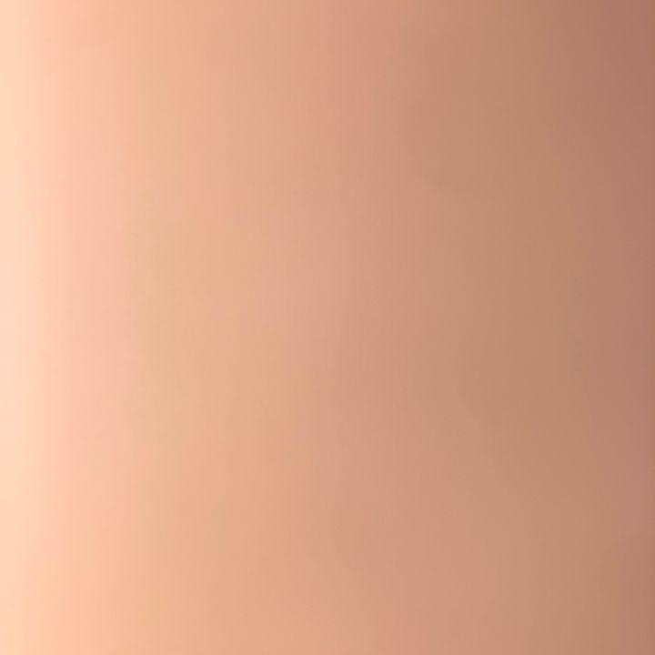 vsd