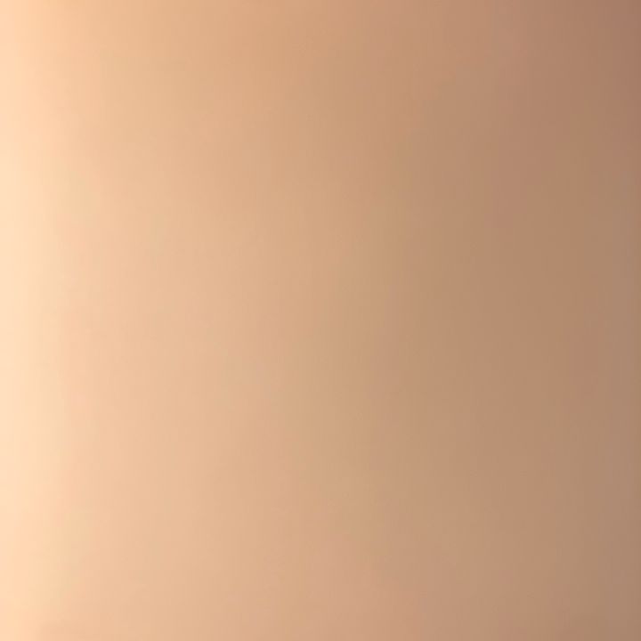 vsd