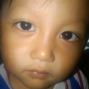 randomcus