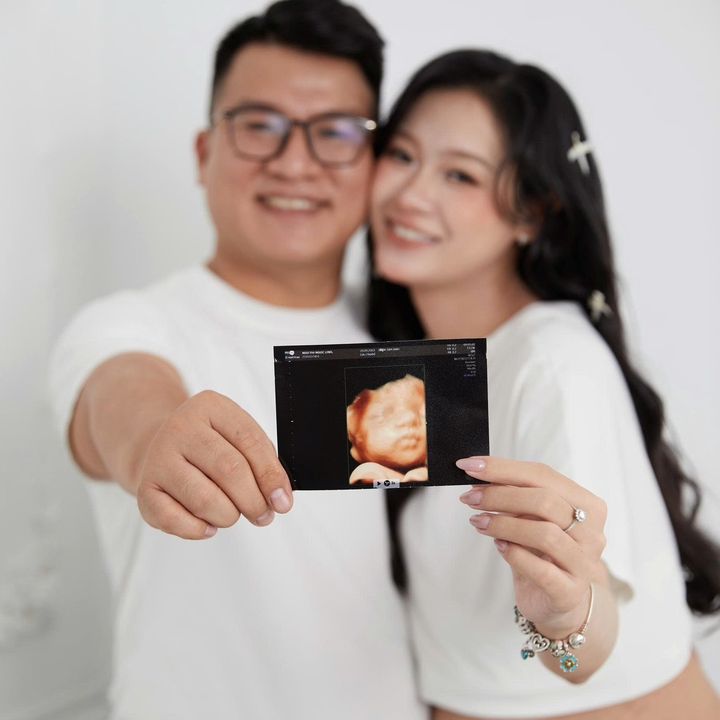 Pony của mẹ Lynk ba Đạt