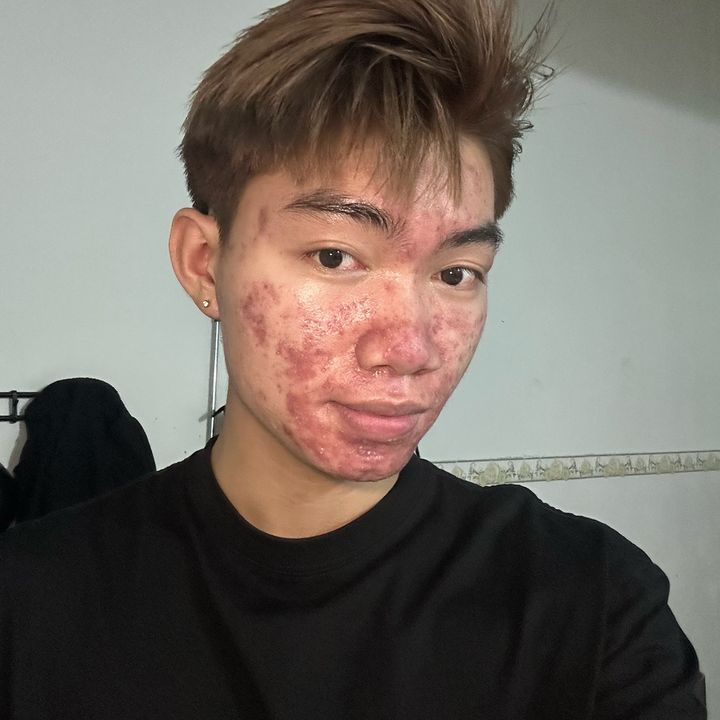 Dũng Thay Đổi