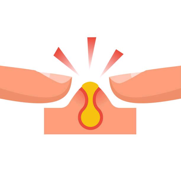 Pimple Pop