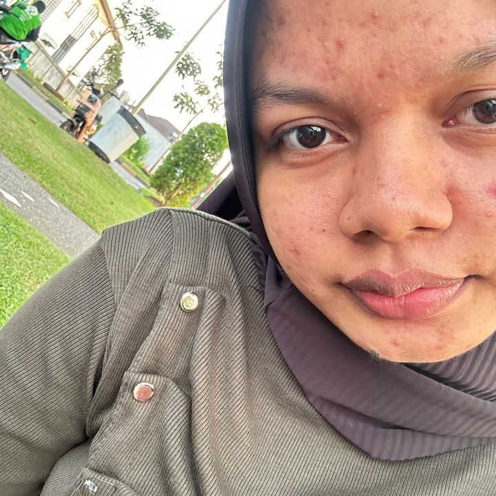 Ica anak baik
