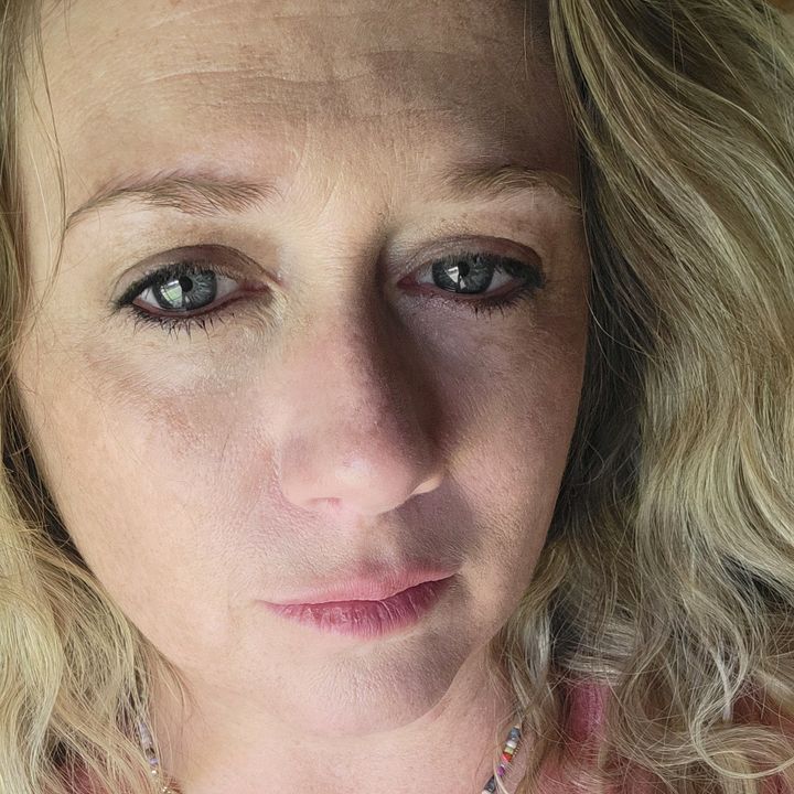 Freckles_2