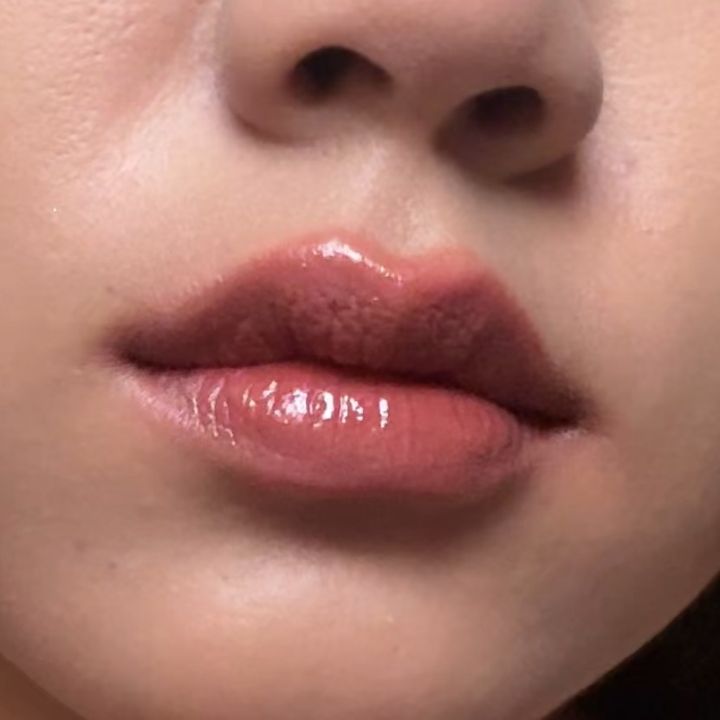 nnewlipss