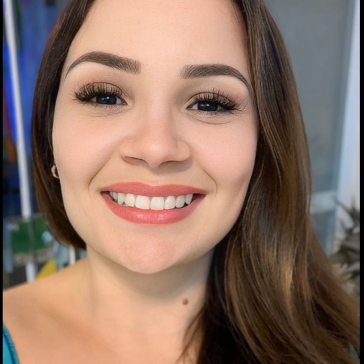 Achadosdaylana