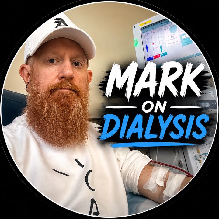 Mark On Dialysis