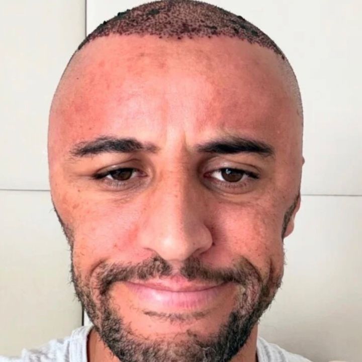 Wesley Doidão