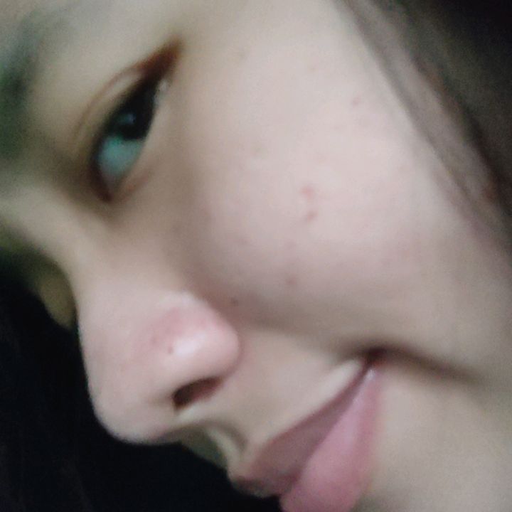 ayoblck