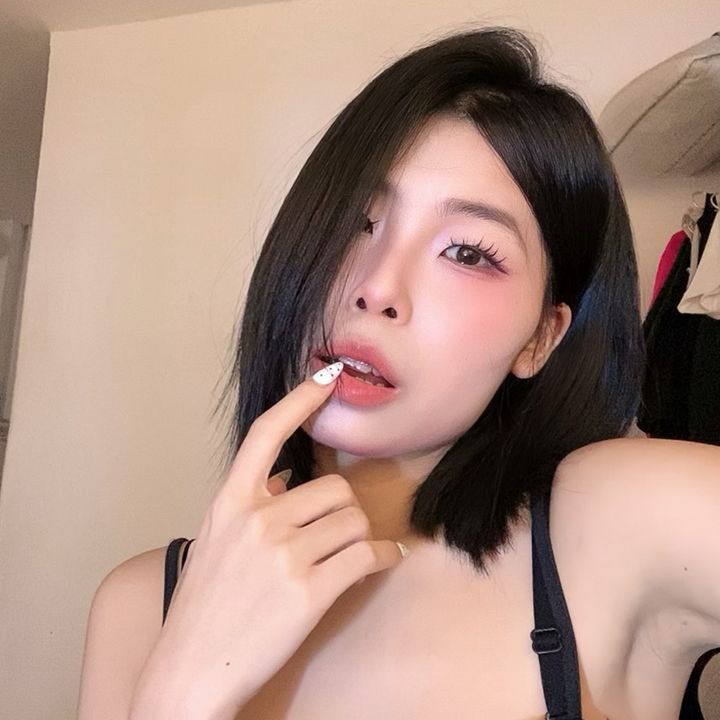 chưa tháo niềng 🍒