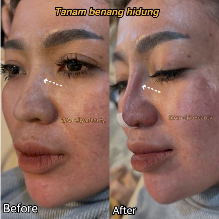 AmeliyaBeauty