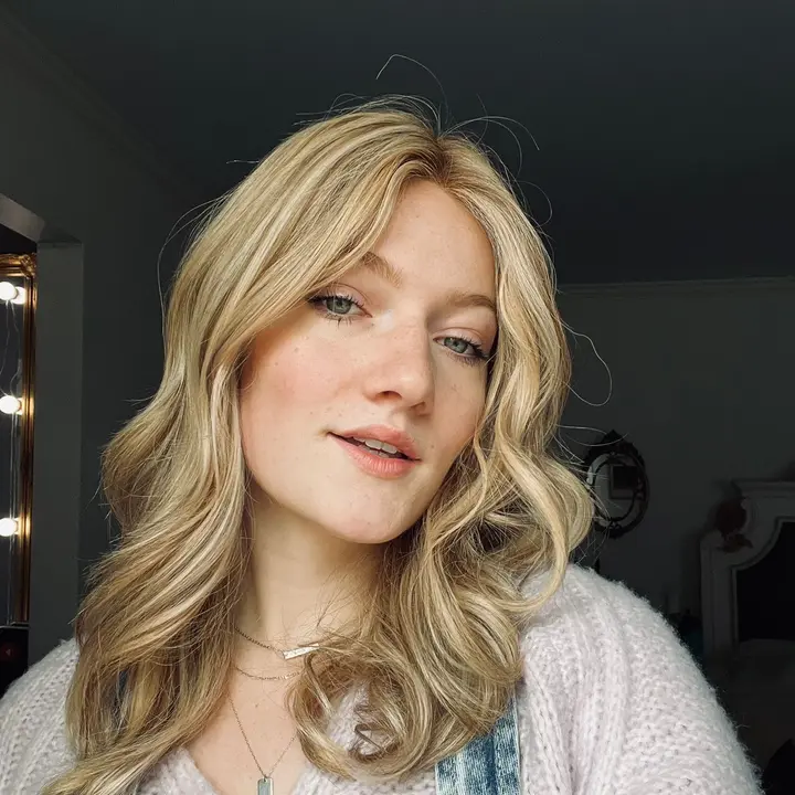 ELYSSA JOY | HAIRLOSS