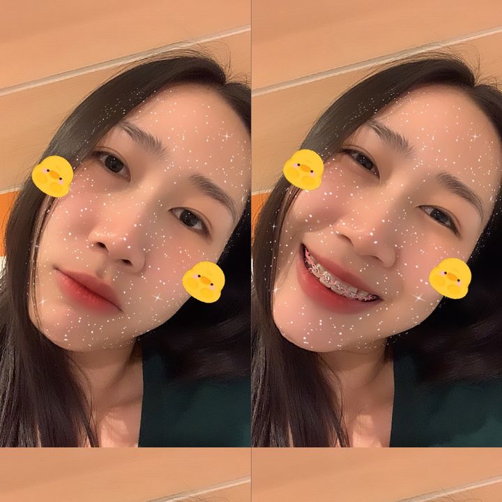 โบตั๋น