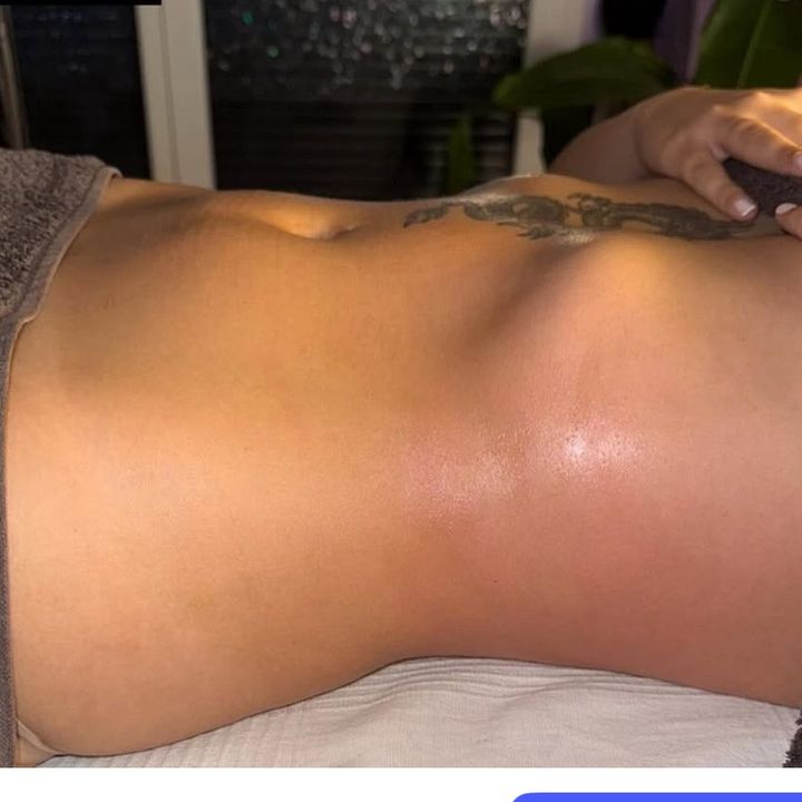 Alma body drainage
